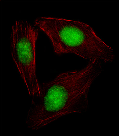 SREBF2 / SREBP2 Antibody - Fluorescent image of U251 cell stained with SREBF2 Antibody. U251 cells were fixed with 4% PFA (20 min), permeabilized with Triton X-100 (0.1%, 10 min), then incubated with SREBF2 primary antibody (1:25, 1 h at 37°C). For secondary antibody, Alexa Fluor 488 conjugated donkey anti-rabbit antibody (green) was used (1:400, 50 min at 37°C). Cytoplasmic actin was counterstained with Alexa Fluor 555 (red) conjugated Phalloidin (7units/ml, 1 h at 37°C). SREBF2 immunoreactivity is localized to Nucleus and Nucleolus significantly.