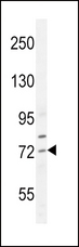SREBF2 / SREBP2 Antibody - SREBF2 Antibody western blot of HepG2 cell line lysates (35 ug/lane). The SREBF2 antibody detected the SREBF2 protein (arrow).