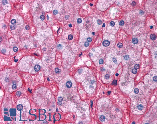 SREBF2 / SREBP2 Antibody - Liver.  This image was taken for the unconjugated form of this product. Other forms have not been tested.