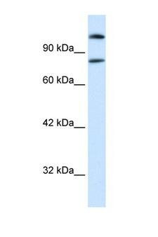 SREBF2 / SREBP2 Antibody - SREBF2 / SREBP-2 antibody Western blot of Raji Cell lysate. Antibody concentration 1 ug/ml. This image was taken for the unconjugated form of this product. Other forms have not been tested.