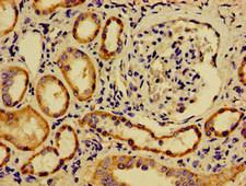 SREBF2 / SREBP2 Antibody - Immunohistochemistry image of paraffin-embedded human kidney tissue at a dilution of 1:100