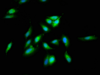 SREBF2 / SREBP2 Antibody - Immunofluorescence staining of Hela cells with SREBF2 Antibody at 1:66, counter-stained with DAPI. The cells were fixed in 4% formaldehyde, permeabilized using 0.2% Triton X-100 and blocked in 10% normal Goat Serum. The cells were then incubated with the antibody overnight at 4°C. The secondary antibody was Alexa Fluor 488-congugated AffiniPure Goat Anti-Rabbit IgG(H+L).