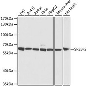 SREBF2 / SREBP2 Antibody - Western blot analysis of extracts of various cell lines, using SREBF2 antibody at 1:3000 dilution. The secondary antibody used was an HRP Goat Anti-Rabbit IgG (H+L) at 1:10000 dilution. Lysates were loaded 25ug per lane and 3% nonfat dry milk in TBST was used for blocking. An ECL Kit was used for detection and the exposure time was 90s.