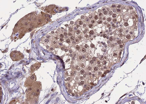 SREBF2 / SREBP2 Antibody - 1:100 staining human Testis tissue by IHC-P. The tissue was formaldehyde fixed and a heat mediated antigen retrieval step in citrate buffer was performed. The tissue was then blocked and incubated with the antibody for 1.5 hours at 22°C. An HRP conjugated goat anti-rabbit antibody was used as the secondary.