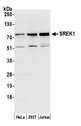 SREK1 / SRRP86 Antibody - Detection of human SREK1 by western blot. Samples: Whole cell lysate (50 µg) from HeLa, HEK293T, and Jurkat cells prepared using NETN lysis buffer. Antibody: Affinity purified rabbit anti-SREK1 antibody used for WB at 0.1 µg/ml. Detection: Chemiluminescence with an exposure time of 30 seconds.