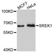 SREK1 / SRRP86 Antibody - Western blot analysis of extracts of various cell lines, using SREK1 antibody at 1:3000 dilution. The secondary antibody used was an HRP Goat Anti-Rabbit IgG (H+L) at 1:10000 dilution. Lysates were loaded 25ug per lane and 3% nonfat dry milk in TBST was used for blocking. An ECL Kit was used for detection and the exposure time was 90s.