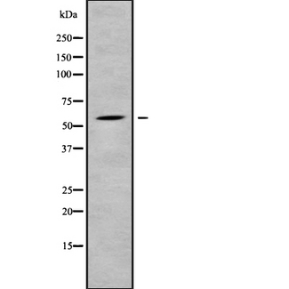 SREK1 / SRRP86 Antibody - Western blot analysis SFRS12 using COLO205 whole cells lysates