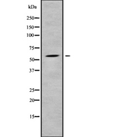 SREK1 / SRRP86 Antibody - Western blot analysis SFRS12 using COLO205 whole cells lysates