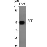 SRF / Serum Response Factor Antibody - Western blot of SRF antibody