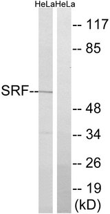SRF / Serum Response Factor Antibody - Western blot analysis of lysates from HeLa cells, using SRF Antibody. The lane on the right is blocked with the synthesized peptide.