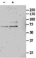 SRF / Serum Response Factor Antibody - SRF antibody (1 ug/ml) staining of untreated (first lane) and TGF-beta 1-treated (second lane) primary cultured Human Lung fibroblast lysate. Primary incubated overnight at 4C. Detected by Western blot of chemiluminescence.