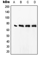 SRF / Serum Response Factor Antibody - Western blot analysis of SRF expression in Jurkat (A); MCF7 (B); HeLa (C); Raw264.7 (D) whole cell lysates.