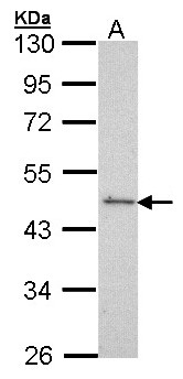 SRF / Serum Response Factor Antibody - Sample (30 ug of whole cell lysate). A: Molt-4. 10% SDS PAGE. SRF antibody diluted at 1:500. 