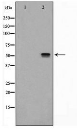 SRF / Serum Response Factor Antibody - Western blot of LOVO cell lysate using SRF Antibody