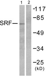 SRF / Serum Response Factor Antibody - Western blot analysis of extracts from NIH/3T3 cells treated with PMA (125ng/ml, 30mins), using SRF (Ab-99) antibody.