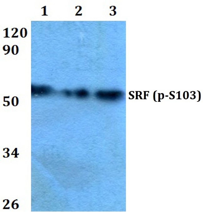 SRF / Serum Response Factor Antibody - Western blot analysis of pSRF (S103) pAb at a 1:500 dilution. Lane 1: HEK293T whole cell lysate. Lane 2: Raw264.7 whole cell lysate. Lane 3: H9C2 whole cell lysate.