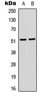 SRF / Serum Response Factor Antibody - Western blot analysis of SRF (pS103) expression in HeLa (A); Jurkat (B) whole cell lysates.
