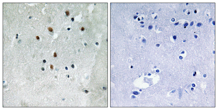 SRF / Serum Response Factor Antibody - Immunohistochemistry analysis of paraffin-embedded human brain, using SRF (Phospho-Ser77) Antibody. The picture on the right is blocked with the phospho peptide.