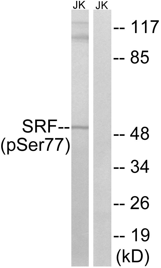 SRF / Serum Response Factor Antibody - Western blot analysis of lysates from Jurkat cells treated with PMA 125ng/ml 30', using SRF (Phospho-Ser77) Antibody. The lane on the right is blocked with the phospho peptide.