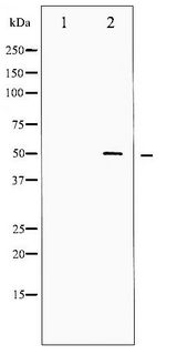SRF / Serum Response Factor Antibody - Western blot of SRF phosphorylation expression in Serum treated LOVO whole cell lysates,The lane on the left is treated with the antigen-specific peptide.