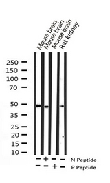 SRF / Serum Response Factor Antibody - Western blot analysis of Phospho-SRF (Ser99) expression in various lysates