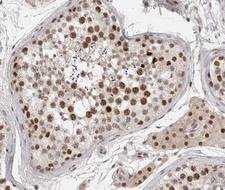 SRF / Serum Response Factor Antibody - 1:200 staining human Testis tissue by IHC-P. The tissue was formaldehyde fixed and a heat mediated antigen retrieval step in citrate buffer was performed. The tissue was then blocked and incubated with the antibody for 1.5 hours at 22°C. An HRP conjugated goat anti-rabbit antibody was used as the secondary.