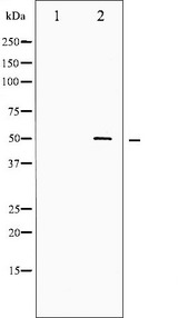 SRF / Serum Response Factor Antibody - Western blot analysis of SRF phosphorylation expression in Serum treated LOVO cells whole cells lysates. The lane on the left is treated with the antigen-specific peptide.