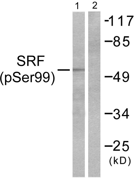 SRF / Serum Response Factor Antibody - Western blot analysis of extracts from LOVO cells treated with serum (20%, 15mins), using SRF (Phospho-Ser99) antibody.