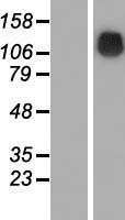 SRGAP1 Protein - Western validation with an anti-DDK antibody * L: Control HEK293 lysate R: Over-expression lysate