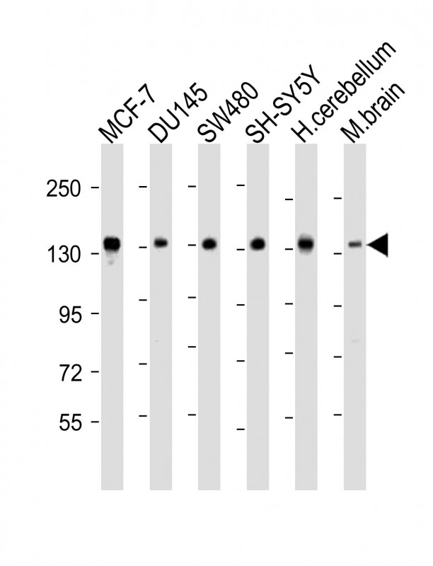 SRGAP2 Antibody - All lanes: Anti-SRGAP2 Antibody (C-term) at 1:2000 dilution. Lane 1: MCF-7 whole cell lysate. Lane 2: DU145 whole cell lysate. Lane 3: SW480 whole cell lysate. Lane 4: SH-SY5Y whole cell lysate. Lane 5: human cerebellum lysate. Lane 6: mouse brain lysate Lysates/proteins at 20 ug per lane. Secondary Goat Anti-Rabbit IgG, (H+L), Peroxidase conjugated at 1:10000 dilution. Predicted band size: 121 kDa. Blocking/Dilution buffer: 5% NFDM/TBST.