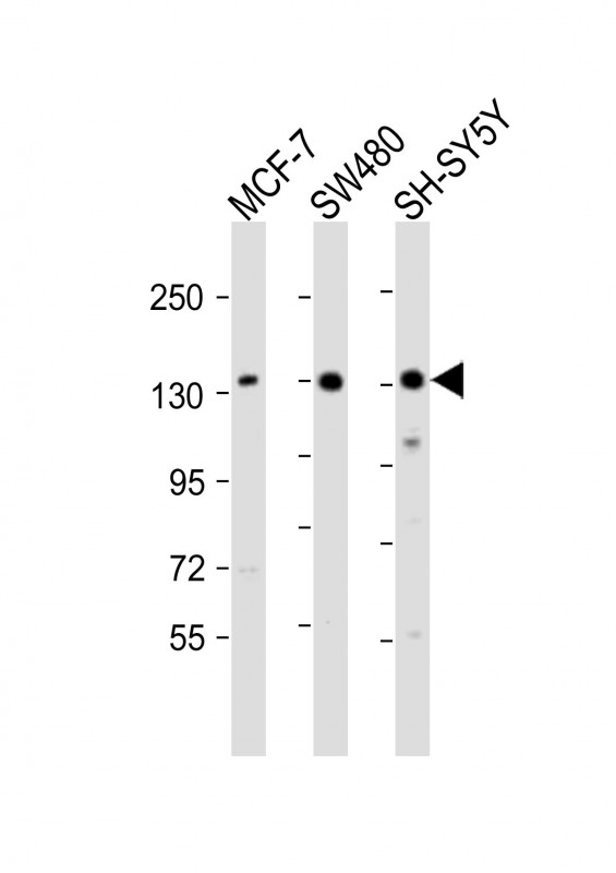 SRGAP2 Antibody - All lanes: Anti-SRGAP2 Antibody (C-term) at 1:2000 dilution. Lane 1: MCF-7 whole cell lysate. Lane 2: SW480 whole cell lysate. Lane 3: SH-SY5Y whole cell lysate Lysates/proteins at 20 ug per lane. Secondary Goat Anti-Rabbit IgG, (H+L), Peroxidase conjugated at 1:10000 dilution. Predicted band size: 121 kDa. Blocking/Dilution buffer: 5% NFDM/TBST.