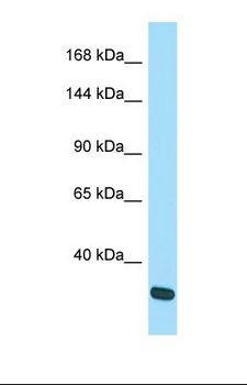 SRGAP3 Antibody - Western blot of Human A549. SRGAP3 antibody dilution 1.0 ug/ml.  This image was taken for the unconjugated form of this product. Other forms have not been tested.