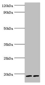 SRGN / Serglycin Antibody - Western blot All lanes: Serglycin antibody at 9µg/ml Lane 1: THP-1 whole cell lysate Lane 2: HL60 whole cell lysate Secondary Goat polyclonal to rabbit IgG at 1/10000 dilution Predicted band size: 18 kDa Observed band size: 18 kDa