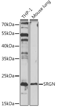 SRGN / Serglycin Antibody - Western blot analysis of extracts of various cell lines, using SRGN antibody at 1:1000 dilution. The secondary antibody used was an HRP Goat Anti-Rabbit IgG (H+L) at 1:10000 dilution. Lysates were loaded 25ug per lane and 3% nonfat dry milk in TBST was used for blocking. An ECL Kit was used for detection and the exposure time was 90s.
