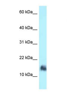 SRGN / Serglycin Antibody - SRGN antibody Western blot of Jurkat Cell lysate. Antibody concentration 1 ug/ml.  This image was taken for the unconjugated form of this product. Other forms have not been tested.