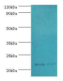 SRI / Sorcin Antibody - Western blot. All lanes: Sorcin antibody at 2 ug/ml. Lane 1: mouse liver tissue. Lane 2: HepG2 whole cell lysate. Secondary antibody: Goat polyclonal to rabbit at 1:10000 dilution. Predicted band size: 22 kDa. Observed band size: 22 kDa Immunohistochemistry.