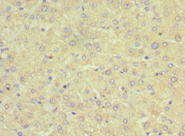 SRI / Sorcin Antibody - Immunohistochemistry of paraffin-embedded human liver tissue using SRI Antibody at dilution of 1:100