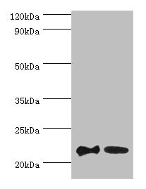 SRI / Sorcin Antibody - Western blot All lanes: SRI antibody at 2µg/ml Lane 1: HepG2 whole cell lysate Lane 2: Hela whole cell lysate Secondary Goat polyclonal to rabbit IgG at 1/10000 dilution Predicted band size: 22, 21 kDa Observed band size: 22 kDa