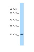 SRI / Sorcin Antibody - SRI antibody Western blot of Jurkat Cell lysate. Antibody concentration 1 ug/ml.  This image was taken for the unconjugated form of this product. Other forms have not been tested.
