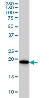 SRI / Sorcin Antibody - SRI monoclonal antibody (M01), clone 1E12 Western Blot analysis of SRI expression in HeLa.