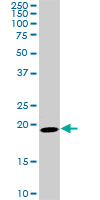 SRI / Sorcin Antibody - SRI monoclonal antibody (M01), clone 1E12. Western Blot analysis of SRI expression in PC-12.