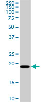 SRI / Sorcin Antibody - SRI monoclonal antibody (M01), clone 1E12. Western Blot analysis of SRI expression in Raw 264.7.