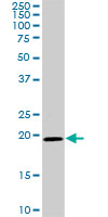 SRI / Sorcin Antibody - SRI monoclonal antibody (M01), clone 1E12. Western Blot analysis of SRI expression in NIH/3T3.