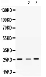 SRI / Sorcin Antibody - Western blot - Anti-SR1 Antibody