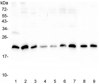 SRI / Sorcin Antibody - Western blot testing of human 1) placenta, 2) U-2 OS, 3) A431, 4) PC-3, 5) HL-60, 6) K562, 7) Caco-2, 8) rat lung and 9) mouse lung lysate with SRI antibody at 0.5ug/ml. Predicted molecular weight ~22 kDa, routinely observed at 22-29 kDa.