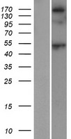 SRL / Sarcalumenin Protein - Western validation with an anti-DDK antibody * L: Control HEK293 lysate R: Over-expression lysate