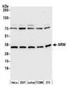 SRM / Spermidine Synthase Antibody - Detection of human and mouse SRM by western blot. Samples: Whole cell lysate (15 µg) from HeLa, HEK293T, Jurkat, mouse TCMK-1, and mouse NIH 3T3 cells prepared using NETN lysis buffer. Antibody: Affinity purified rabbit anti-SRM antibody used for WB at 0.1 µg/ml. Detection: Chemiluminescence with an exposure time of 30 seconds.