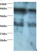 SRM / Spermidine Synthase Antibody - Western blot of spermidine synthase antibody at 2 ug/ml. Lane 1: EC109 whole cell lysate. Lane 2: 293T whole cell lysate. Secondary: Goat polyclonal to Rabbit IgG at 1:15000 dilution. Predicted band size: 33.2 kDa. Observed band size: 38 kDa Additional bands at: 80 kDa. We are unsure as to the identity of this extra band.  This image was taken for the unconjugated form of this product. Other forms have not been tested.