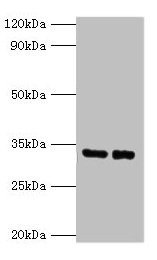 SRM / Spermidine Synthase Antibody - Western blot All lanes: spermidine synthase antibody at 2µg/ml Lane 1: EC109 whole cell lysate Lane 2: 293T whole cell lysate Secondary Goat polyclonal to rabbit IgG at 1/15000 dilution Predicted band size: 33.2 kDa Observed band size: 33.2 kDa