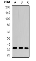 SRM / Spermidine Synthase Antibody - Western blot analysis of SPDSY expression in HepG2 (A); mouse stomach (B); rat liver (C) whole cell lysates.